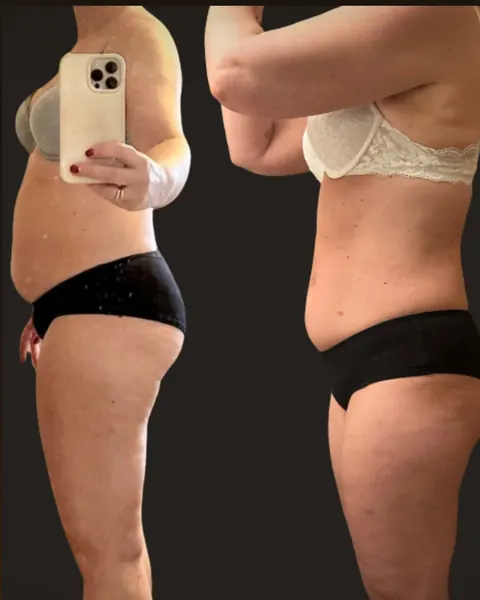 Før og etter: kvinne på 53 år, 10 kilo og 15 centimeter ned