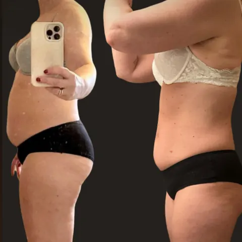 Før og etter: kvinne på 53 år, 10 kilo og 15 centimeter ned