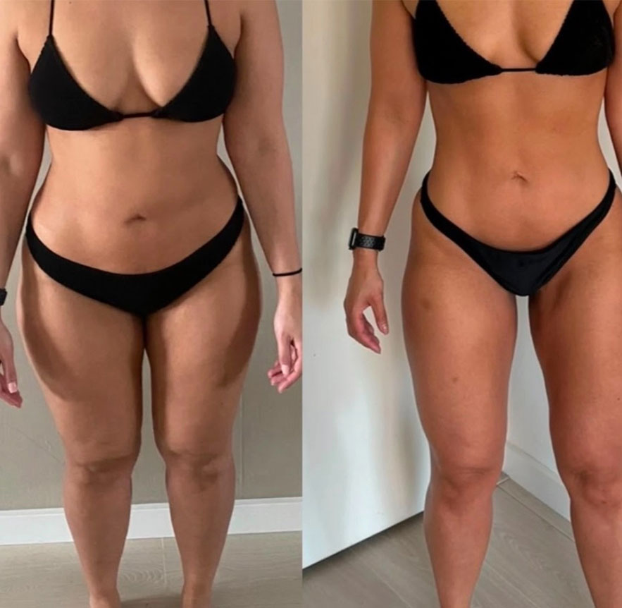 Transformation 1