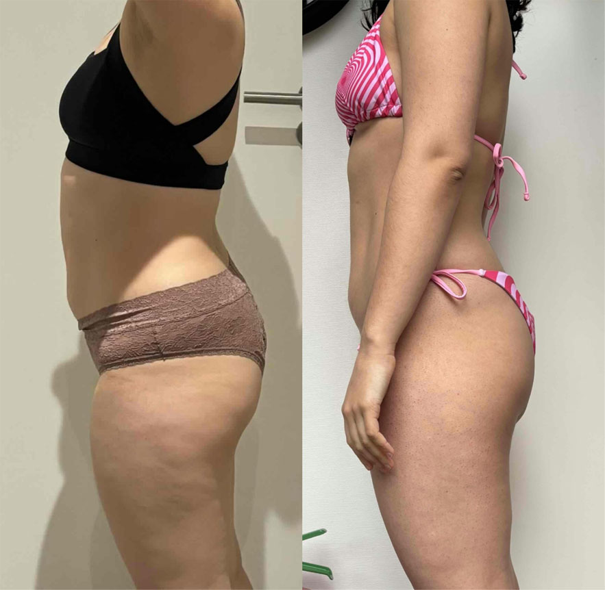 Transformation 2