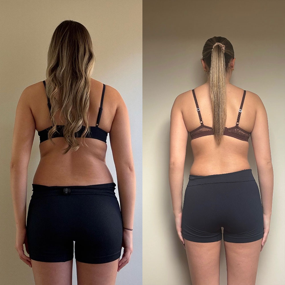 Transformation 2