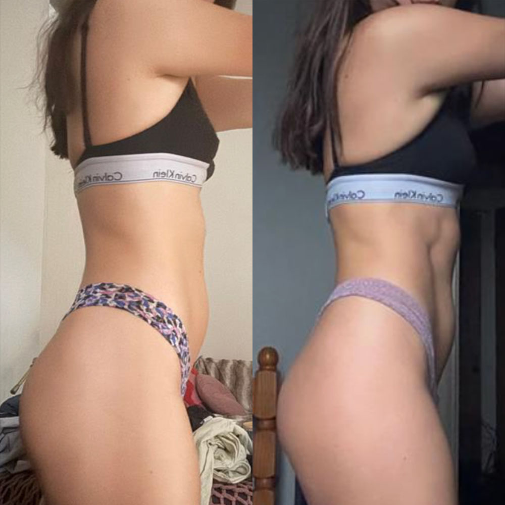 Transformation 3