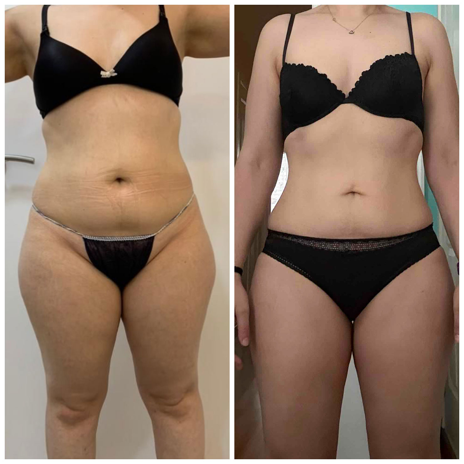 Transformation 3