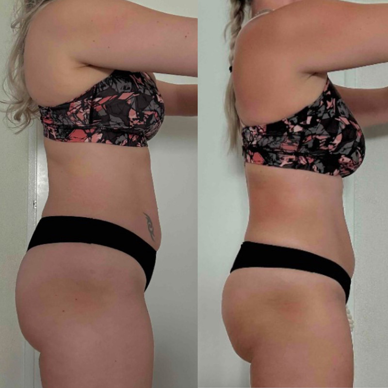 Transformation 3