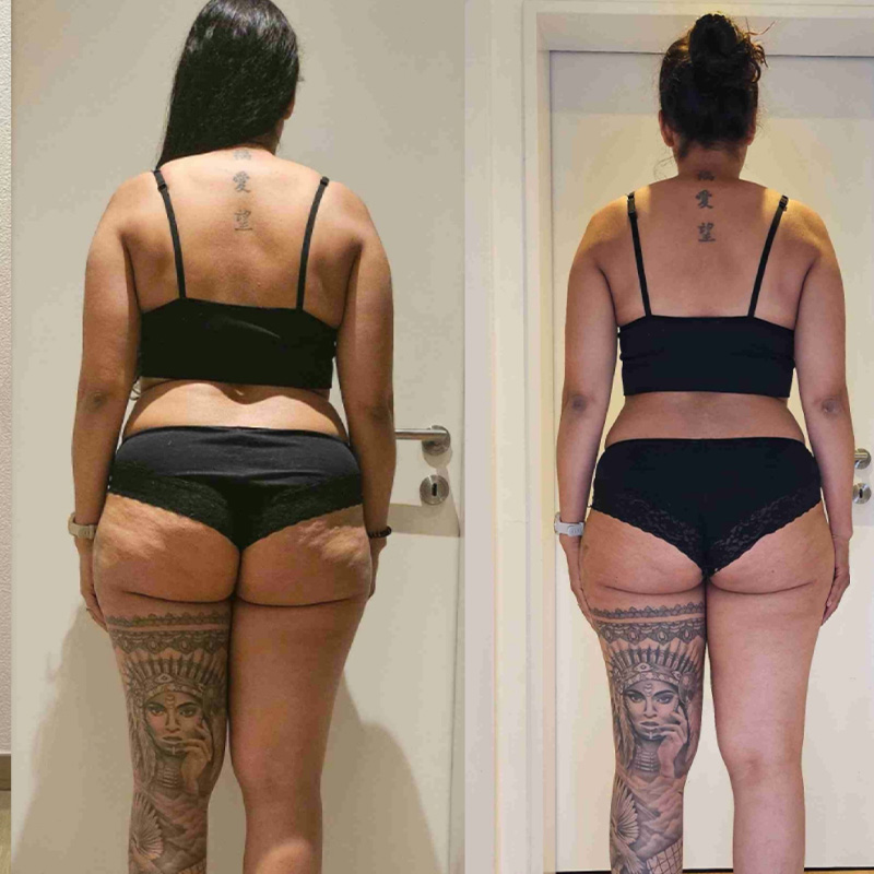 Transformation 6