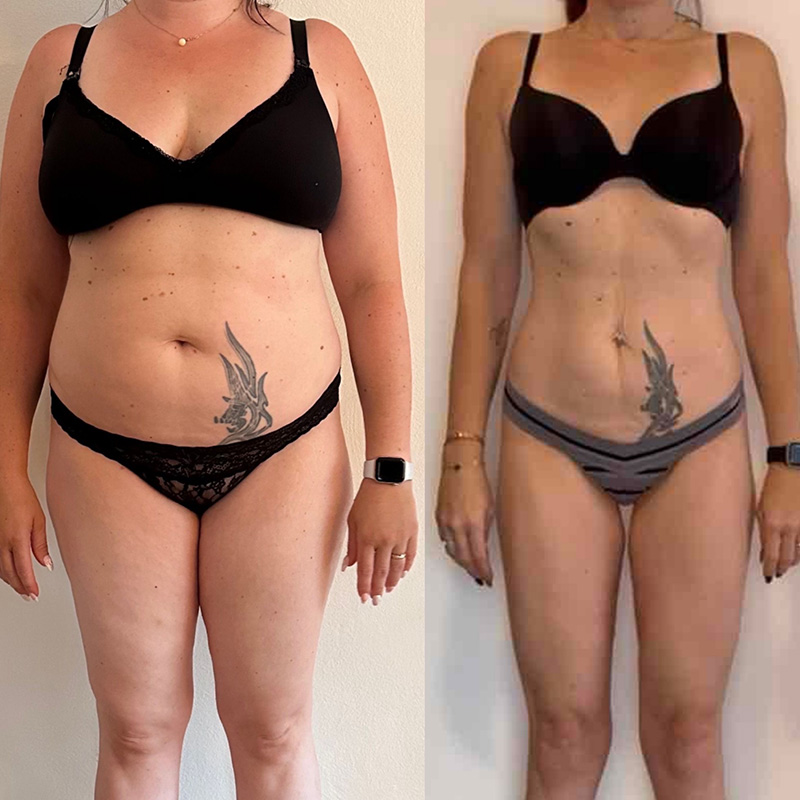 Transformation 4