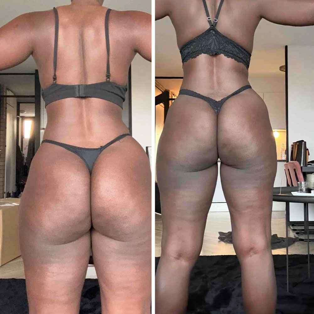 Transformation 2