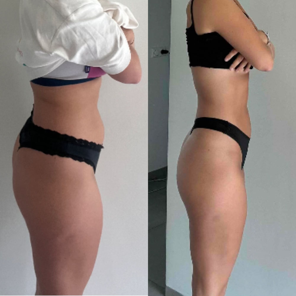Transformation 1