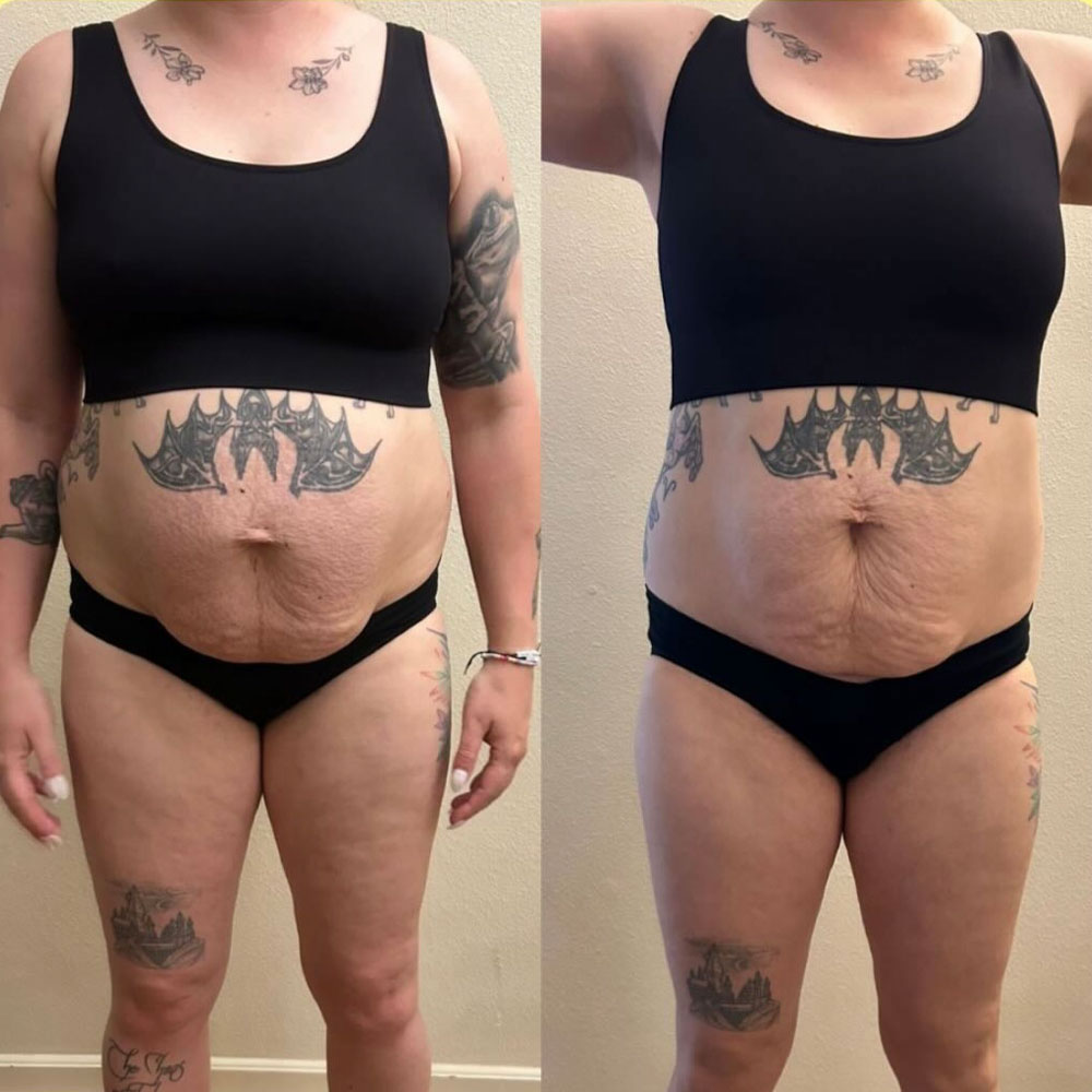 Transformation 2