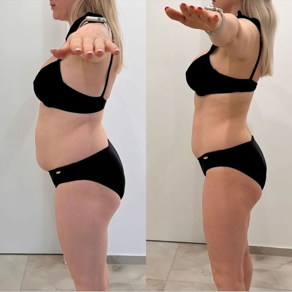 Transformation 4