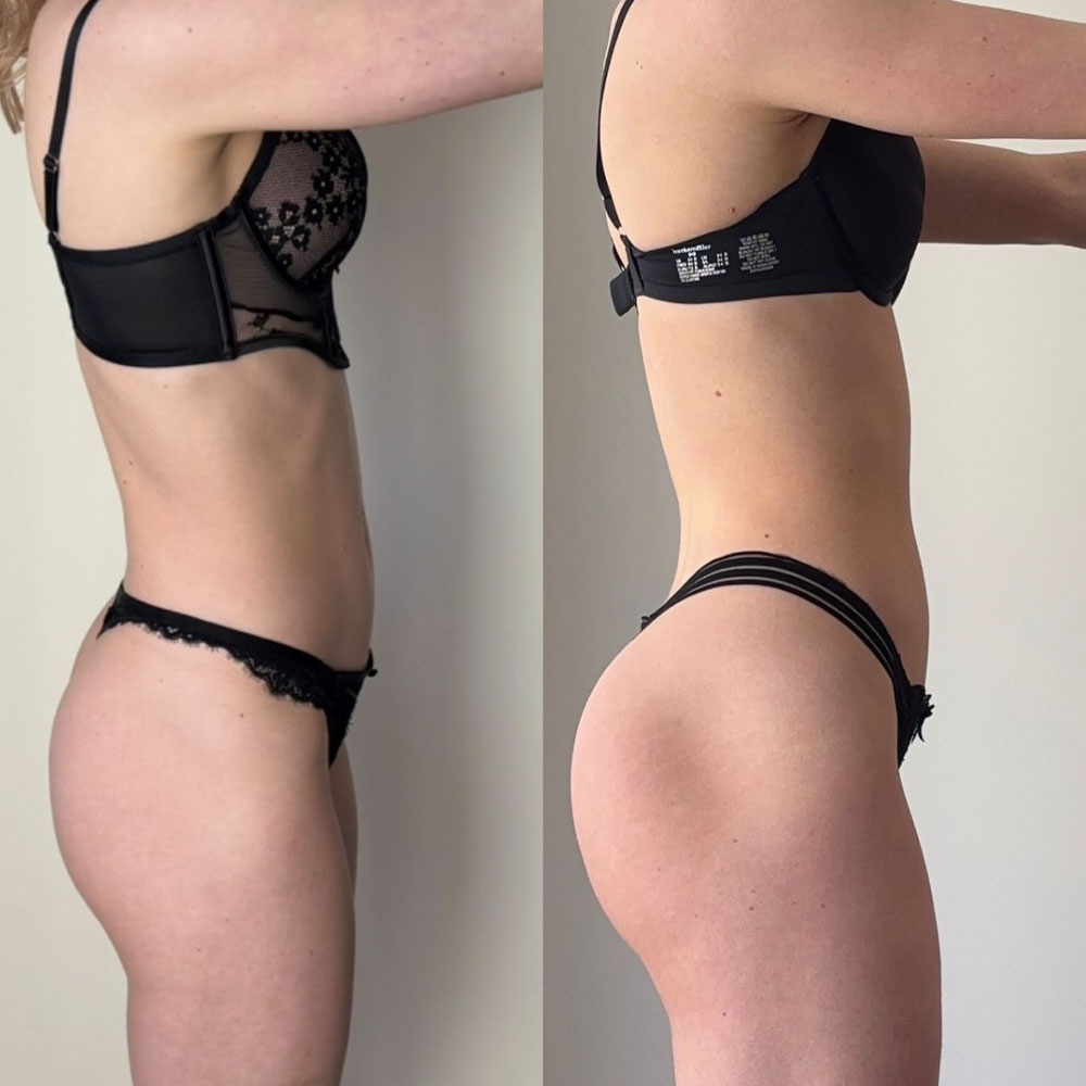 Transformation 1