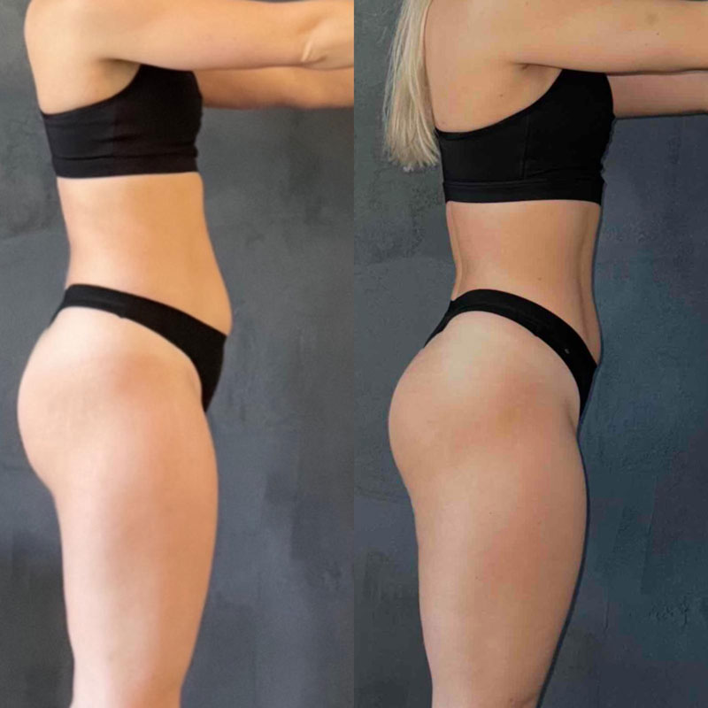 Transformation 3