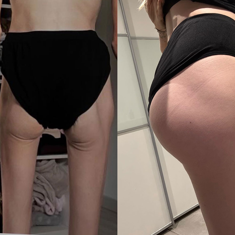 Transformation 5