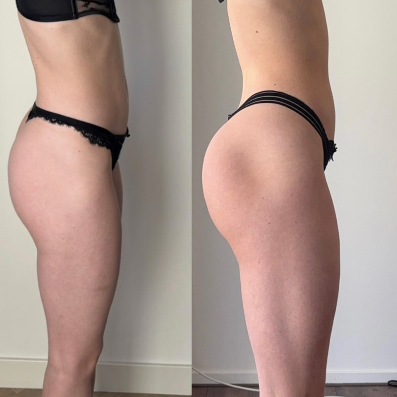 Transformation 2