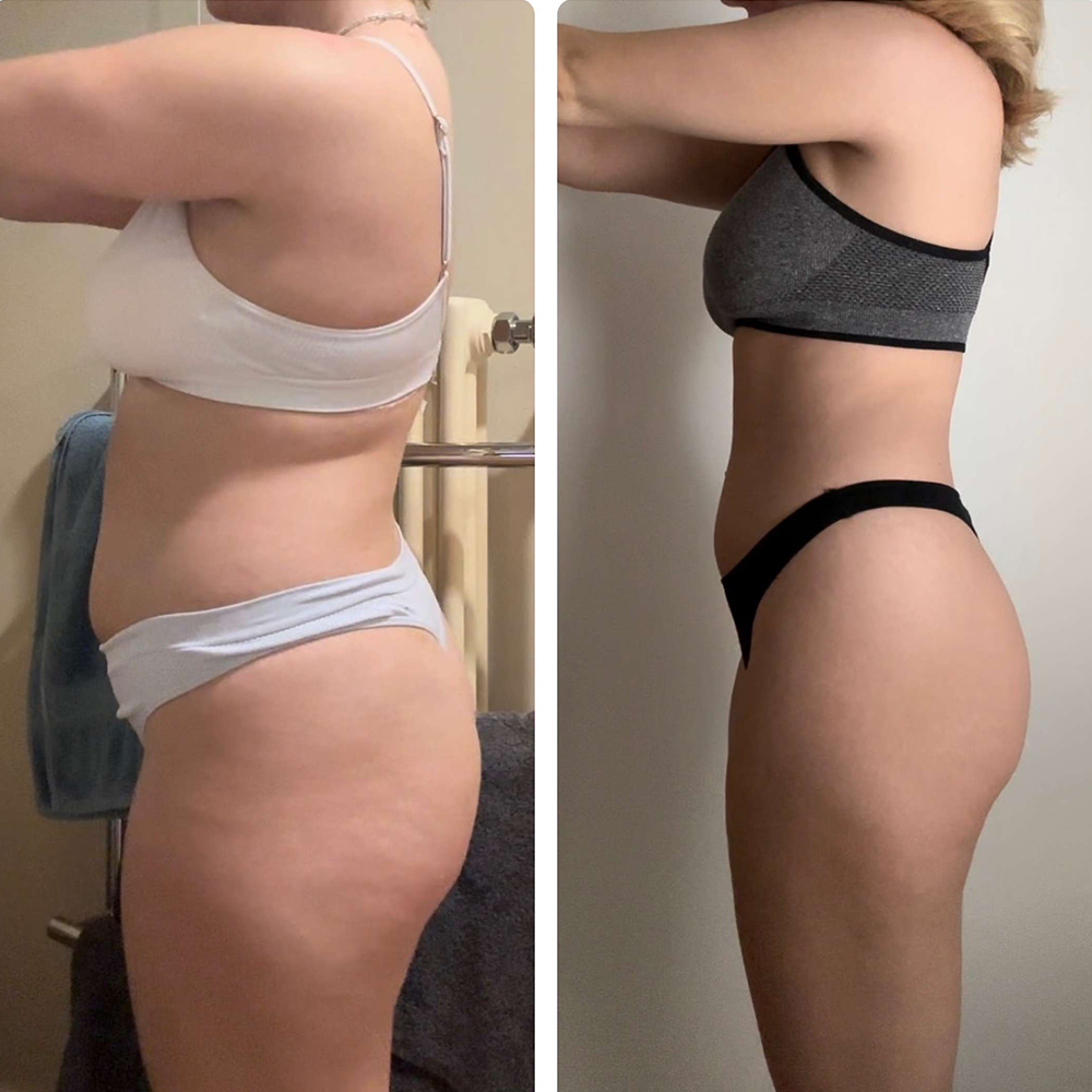 Transformation 3