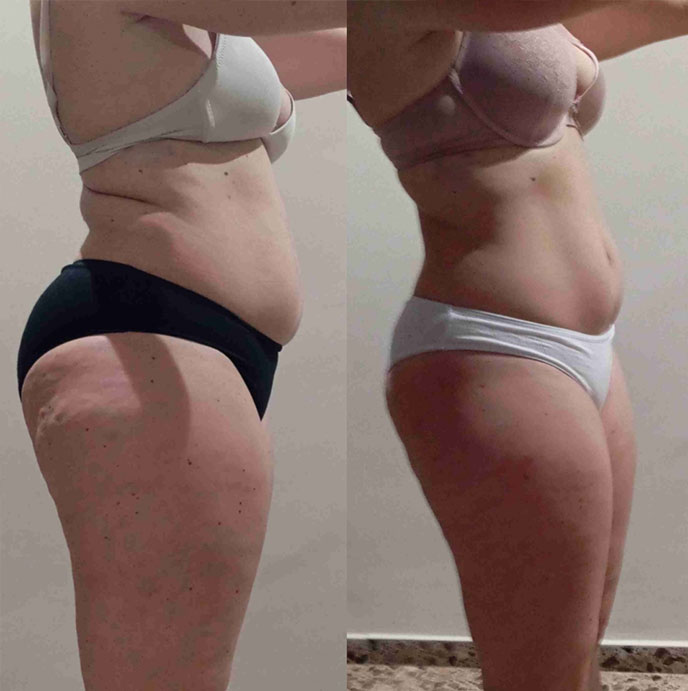 Transformation 2
