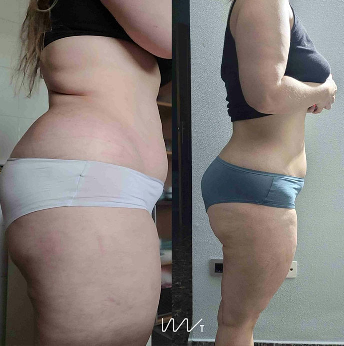 Transformation 5