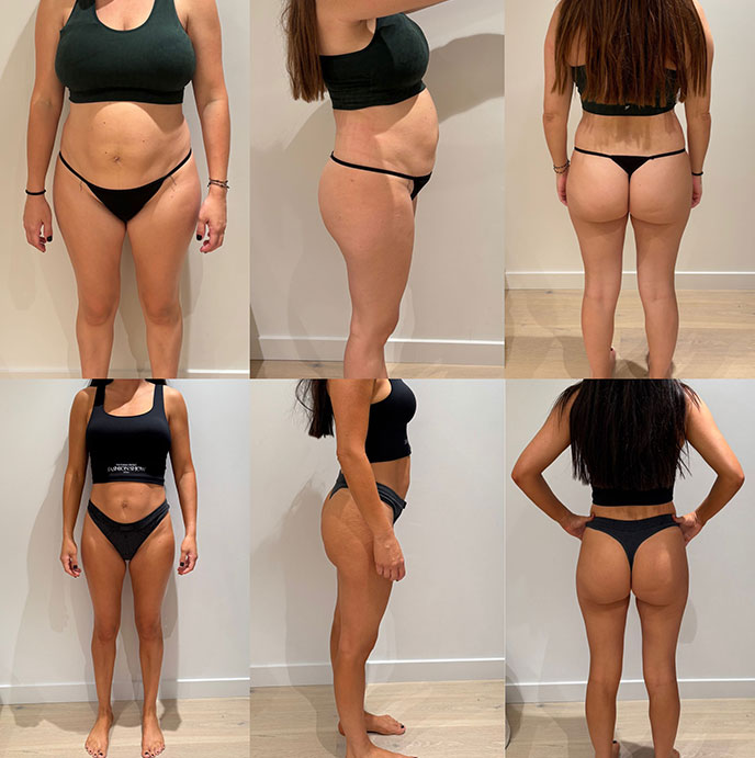 Transformation 3