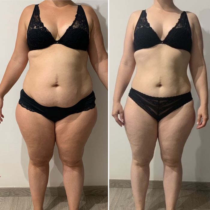 Transformation 1